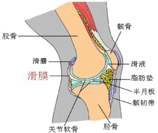 滑膜炎常出现在膝关节!