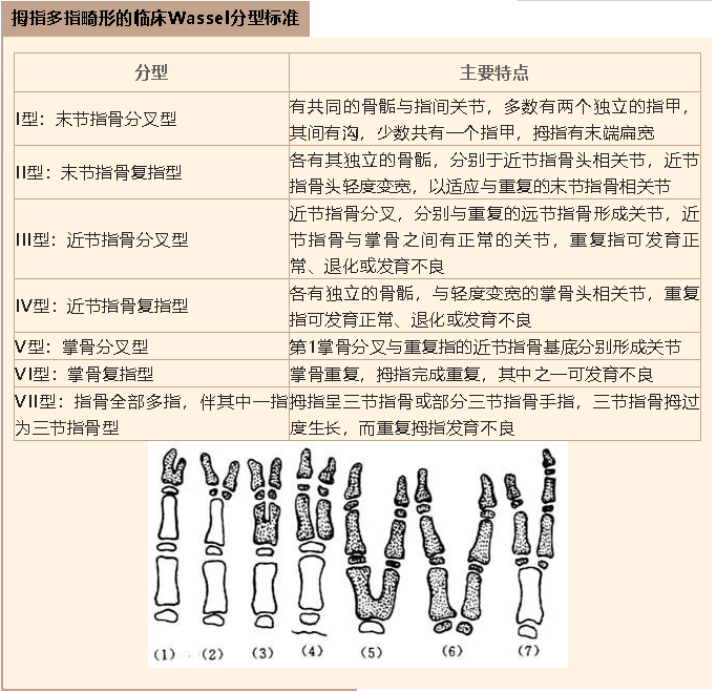 六指畸形x线报告图片