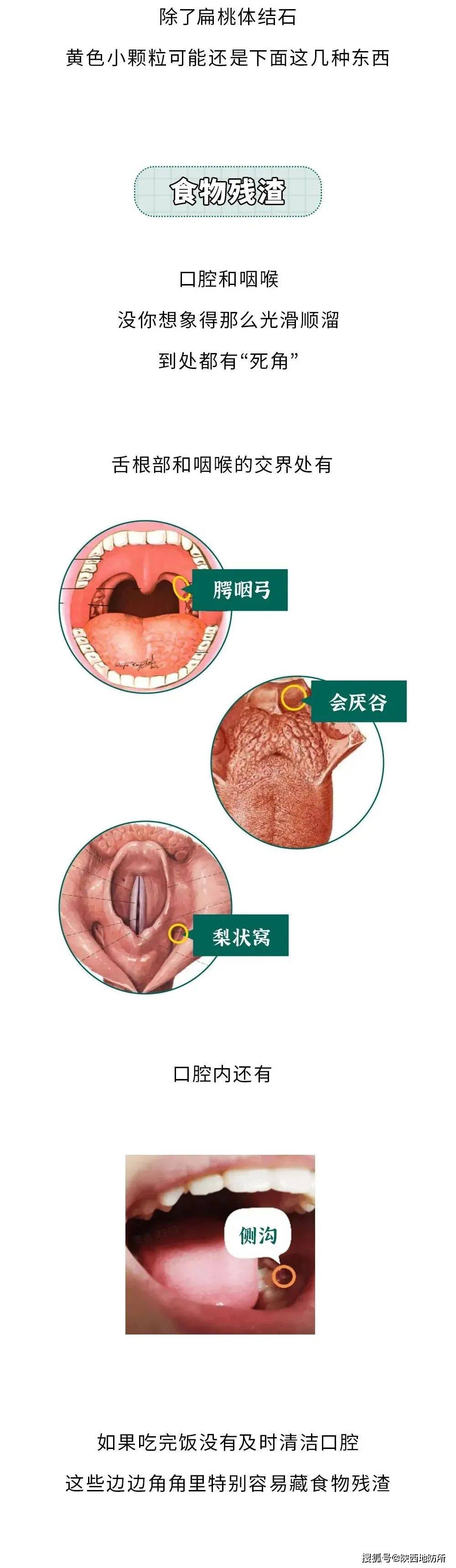 咽喉布满血丝图片