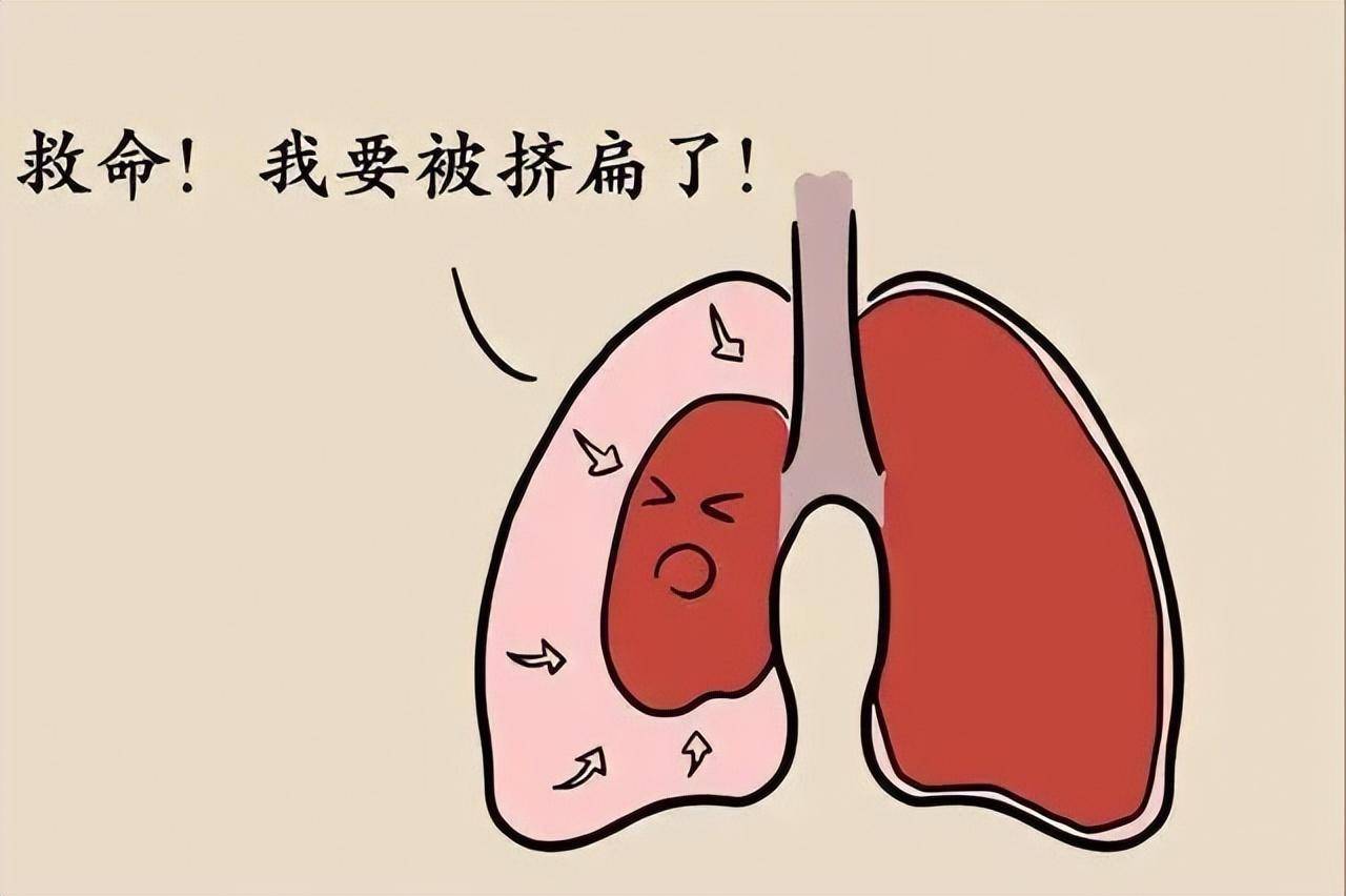 17岁少年肺部藏"定时炸弹",医生胸腔镜下妙手"解除警报"_手术_气胸