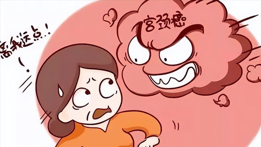 哪些检查可以筛出宫颈癌?