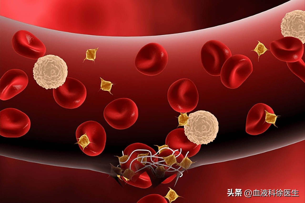 当血小板减少时,身体会有哪些异常表现?_王大妈_检查_血液