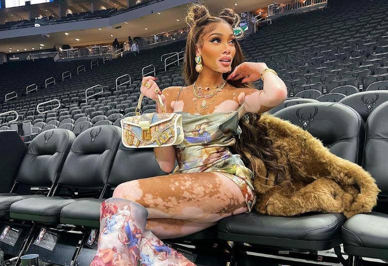 库兹马女友哪吒头!一身白斑好特别,秀极品臀腰比,nba风景线