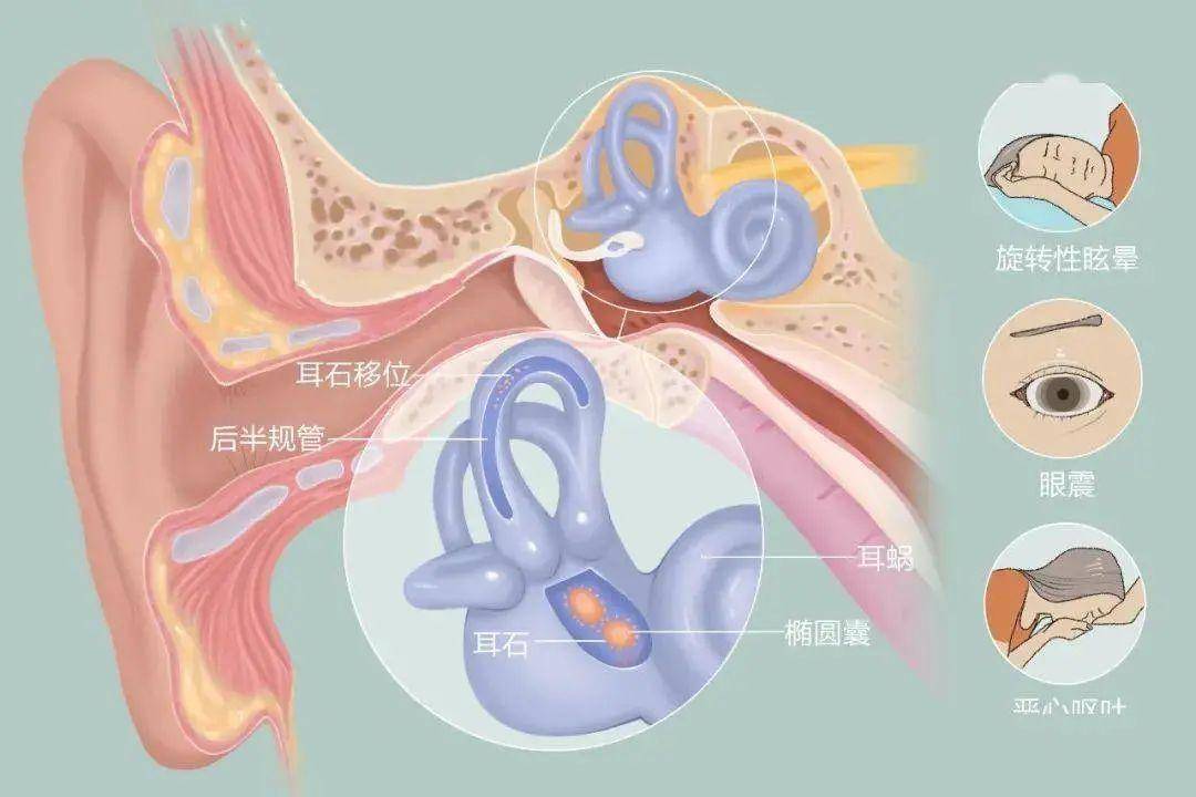 有一種眩暈叫