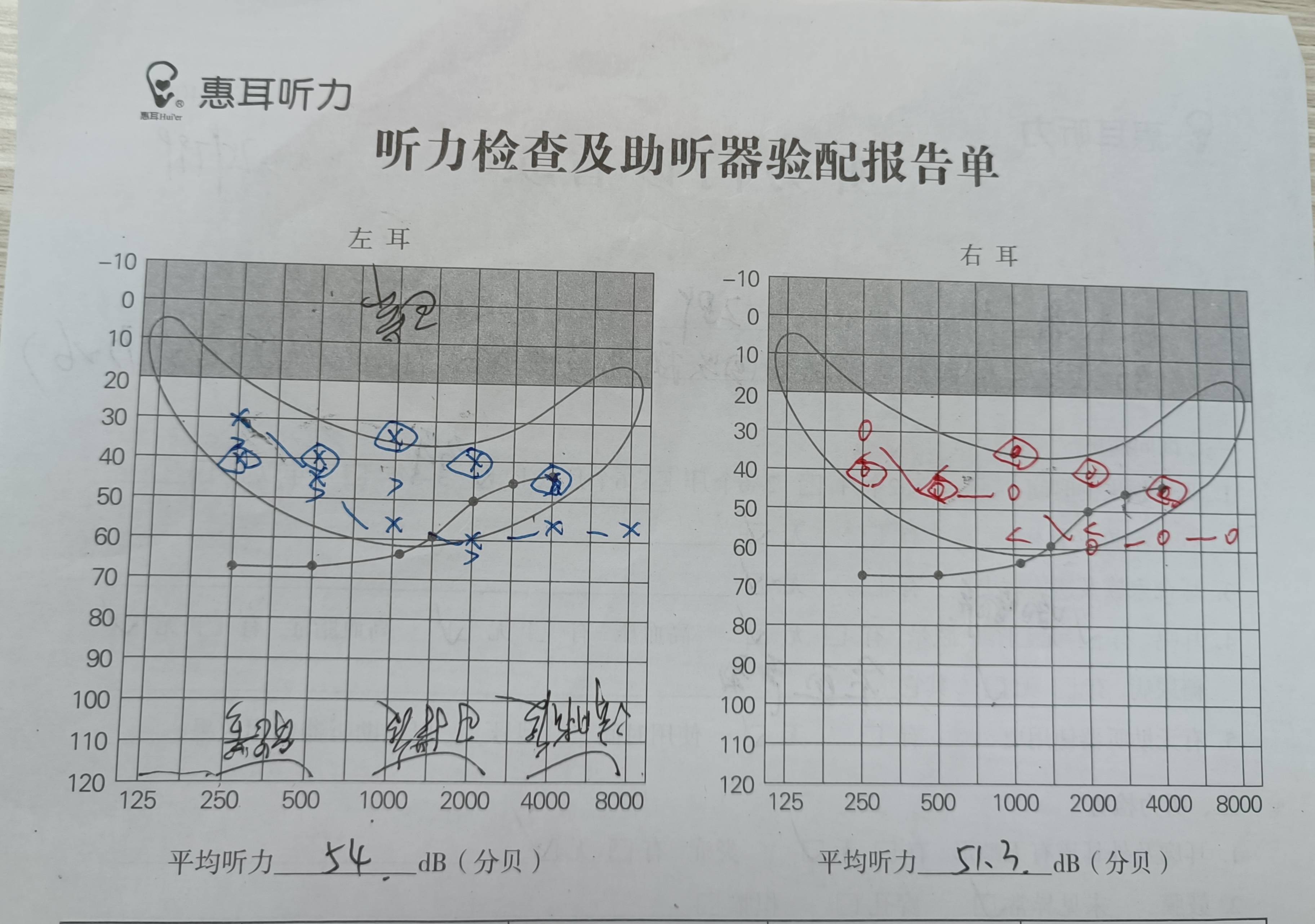 耳镜检查报告图片图片