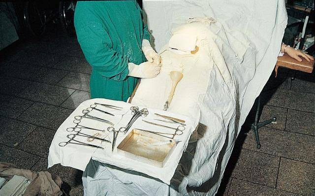 剖腹产横切和竖切哪个更好?