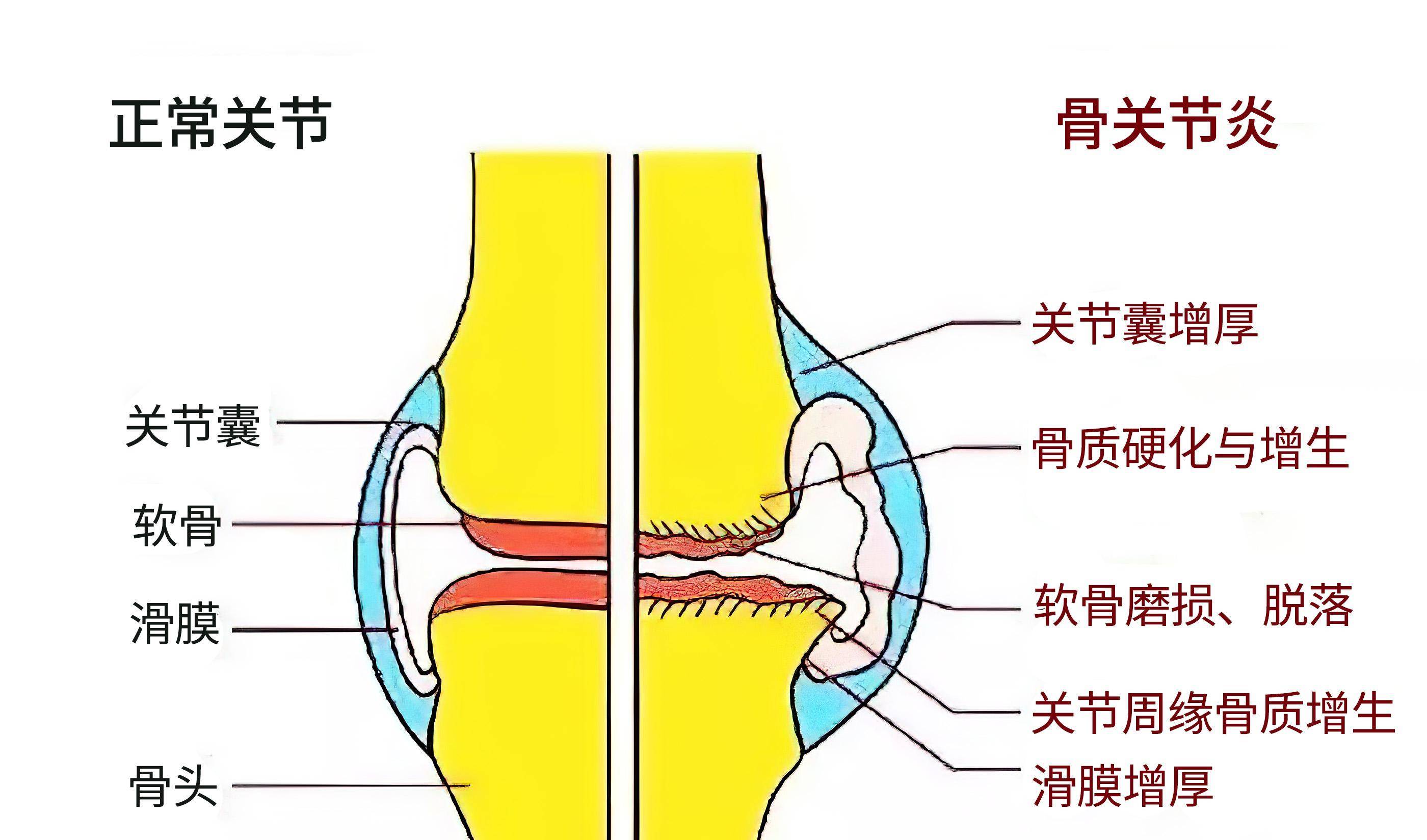 医生教你4招应对