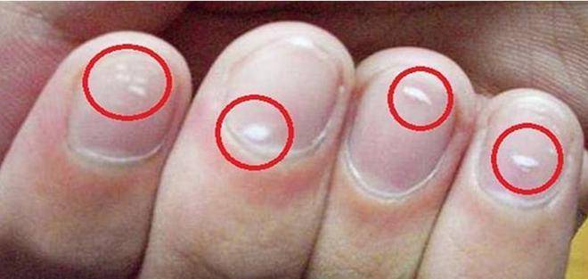 指甲白色是什么原因图片