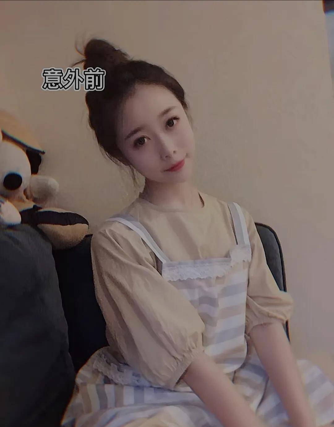 烧伤毁容截肢的24岁女孩,向伤而生的折翼天使—乔燕_生活_双手_命运