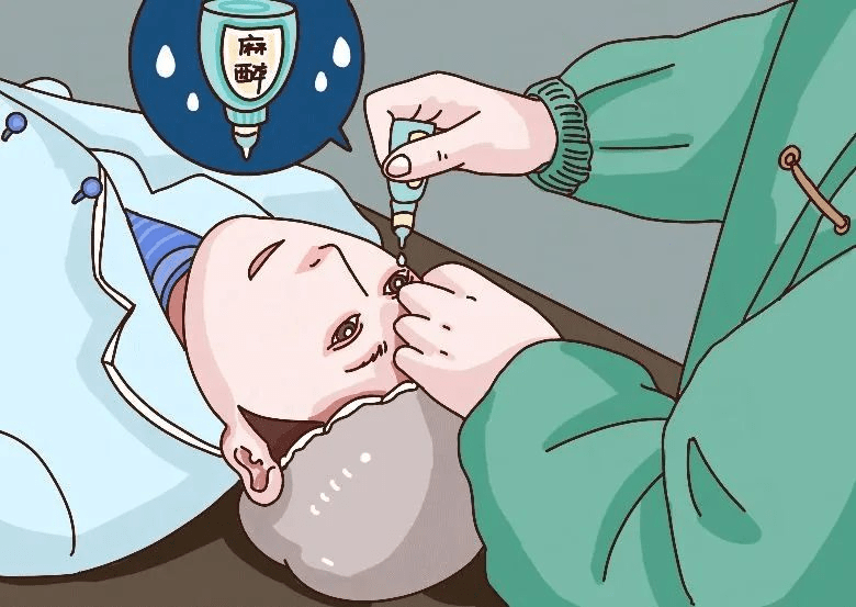 滴麻醉眼药水对角膜进行表面麻醉.