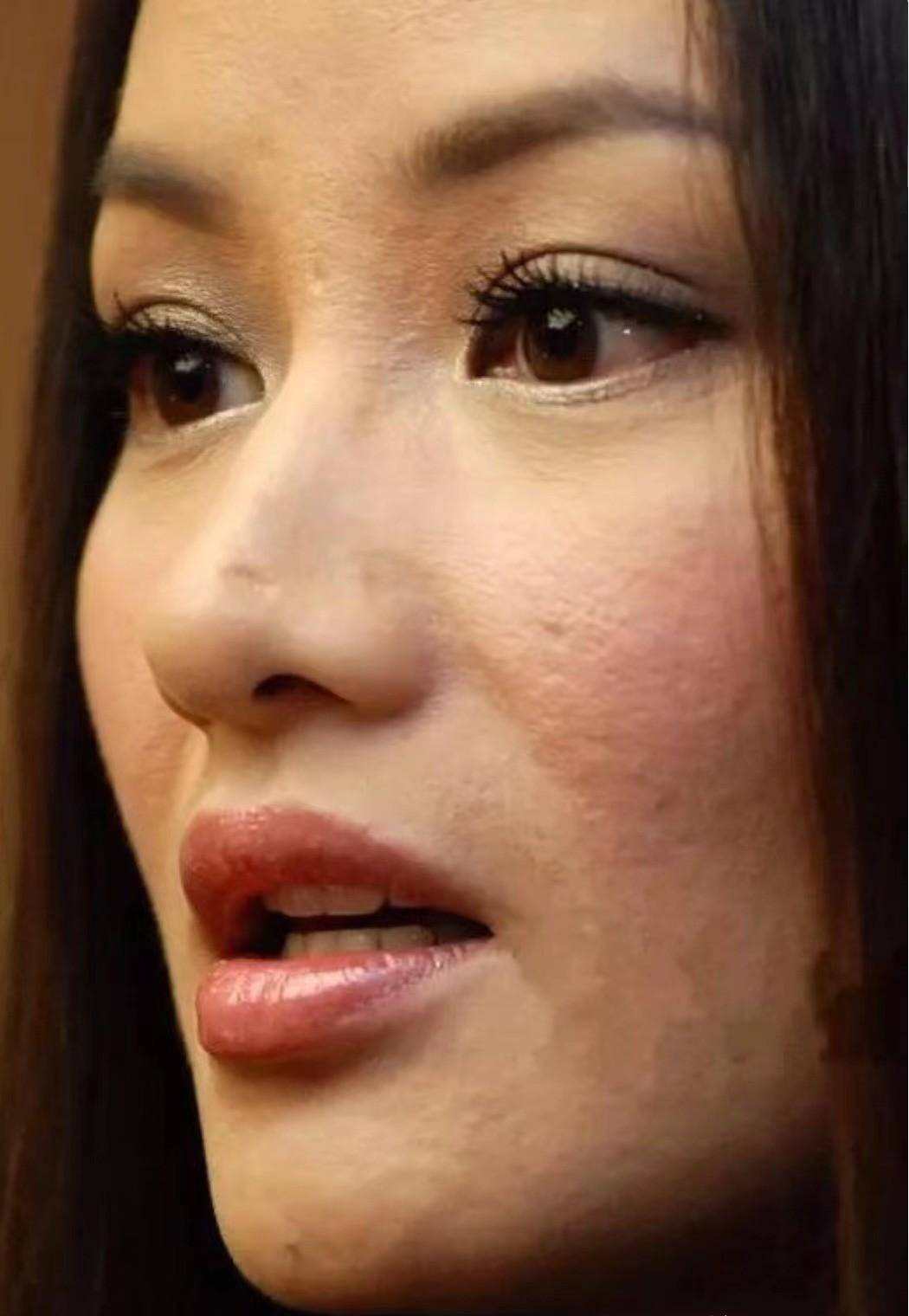 瞿颖早些年的皮肤状态很明显毛孔粗大,长痘留坑,脸部状态看起来也是