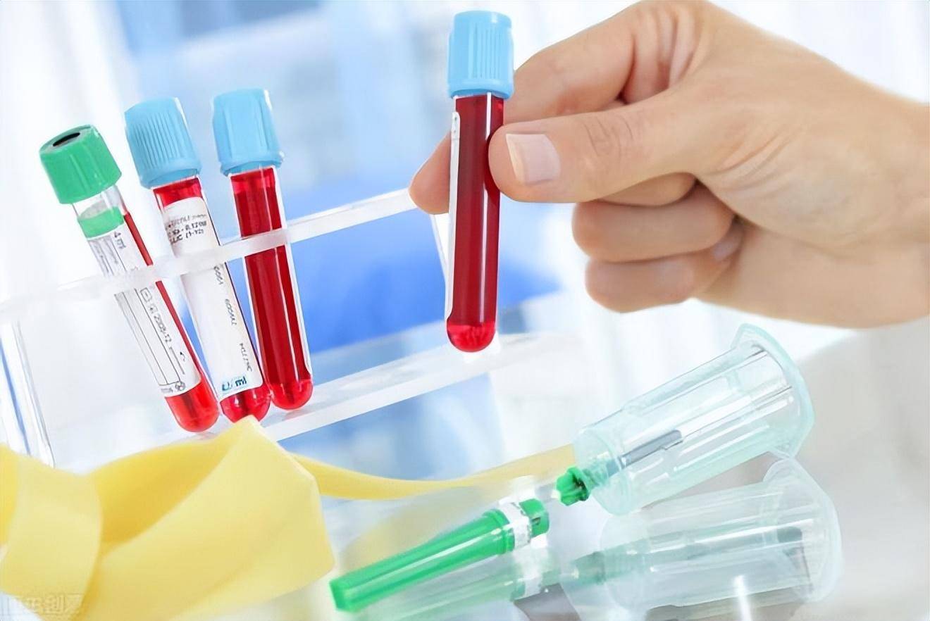 原创            发现甘油三酯高，怎样才能降下来？支招：这3个方法，比较靠谱