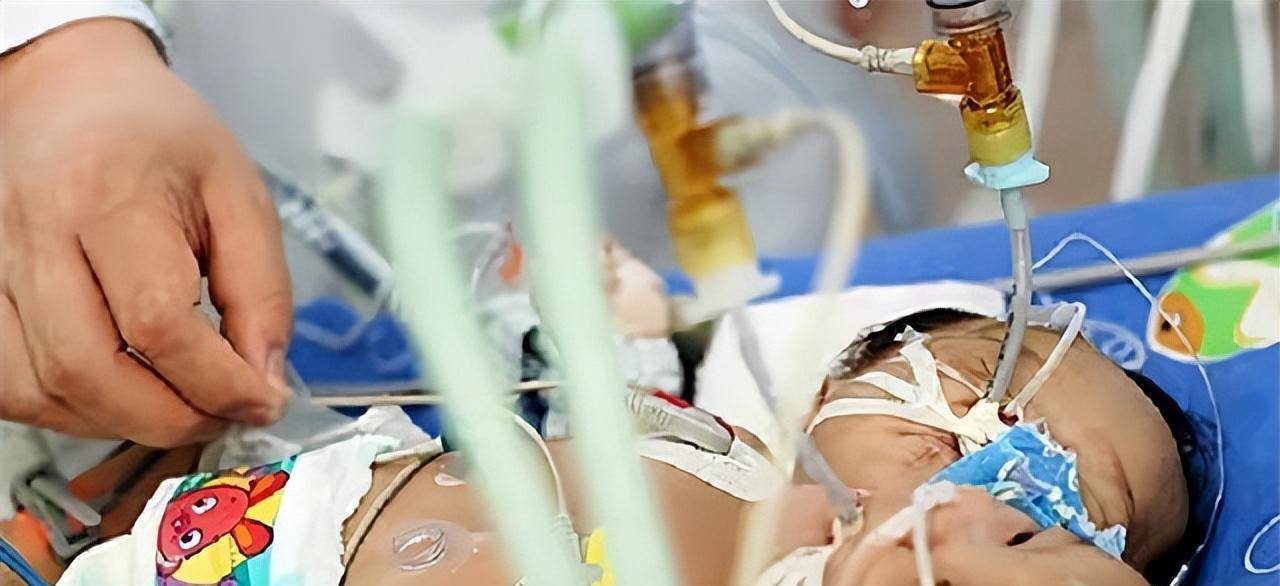 诞下中国首例"双头女婴",后将产检医院告上法庭_包侨英_廖国军_遂宁