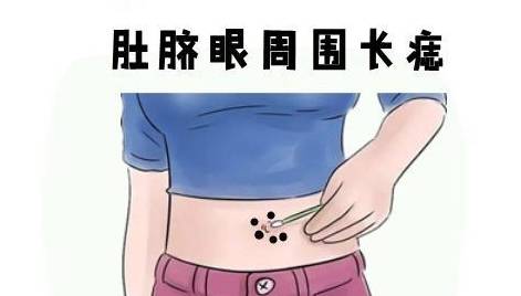 女人身上痣的含义大揭秘，这些部位的痣你知道吗？