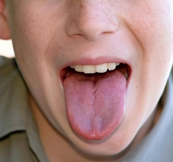 吸毒的人的舌头图片图片