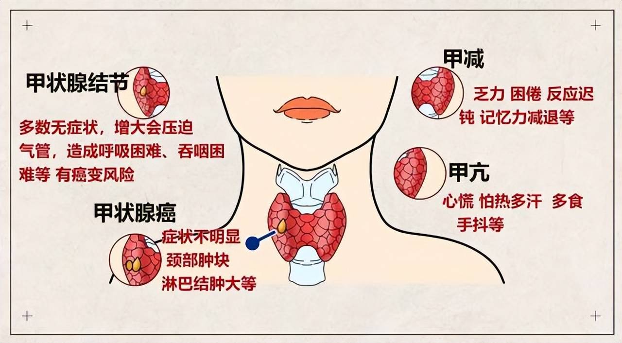 甲状腺人体图片