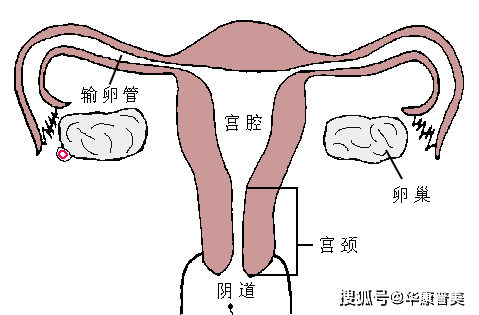 揭开输卵管超声造影的"神秘面纱"_检查_子宫_动态