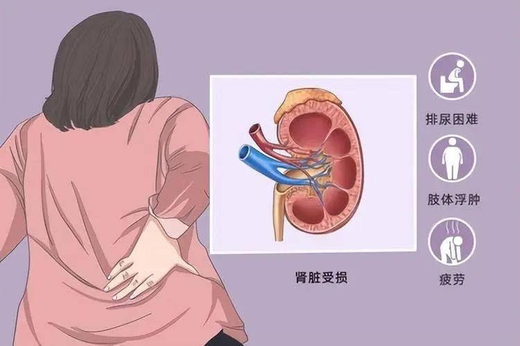 高血压,糖尿病,痛风,肥胖……这些都会伤害你的肾_患者_肾脏_症状