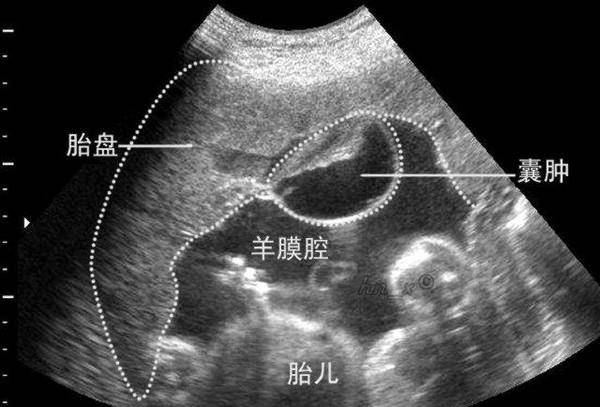 速看（假装怀孕恶搞母亲）妈妈假装要生了孩子会怎样 第8张