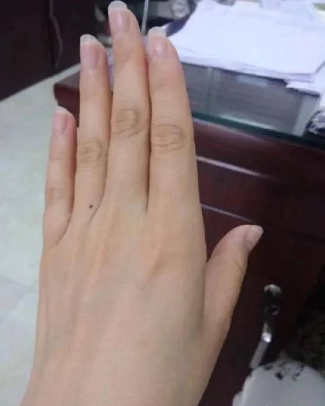 古代流传的手脚胎记解析_生活_手背_才华