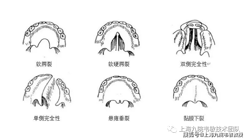 九院韦敏 