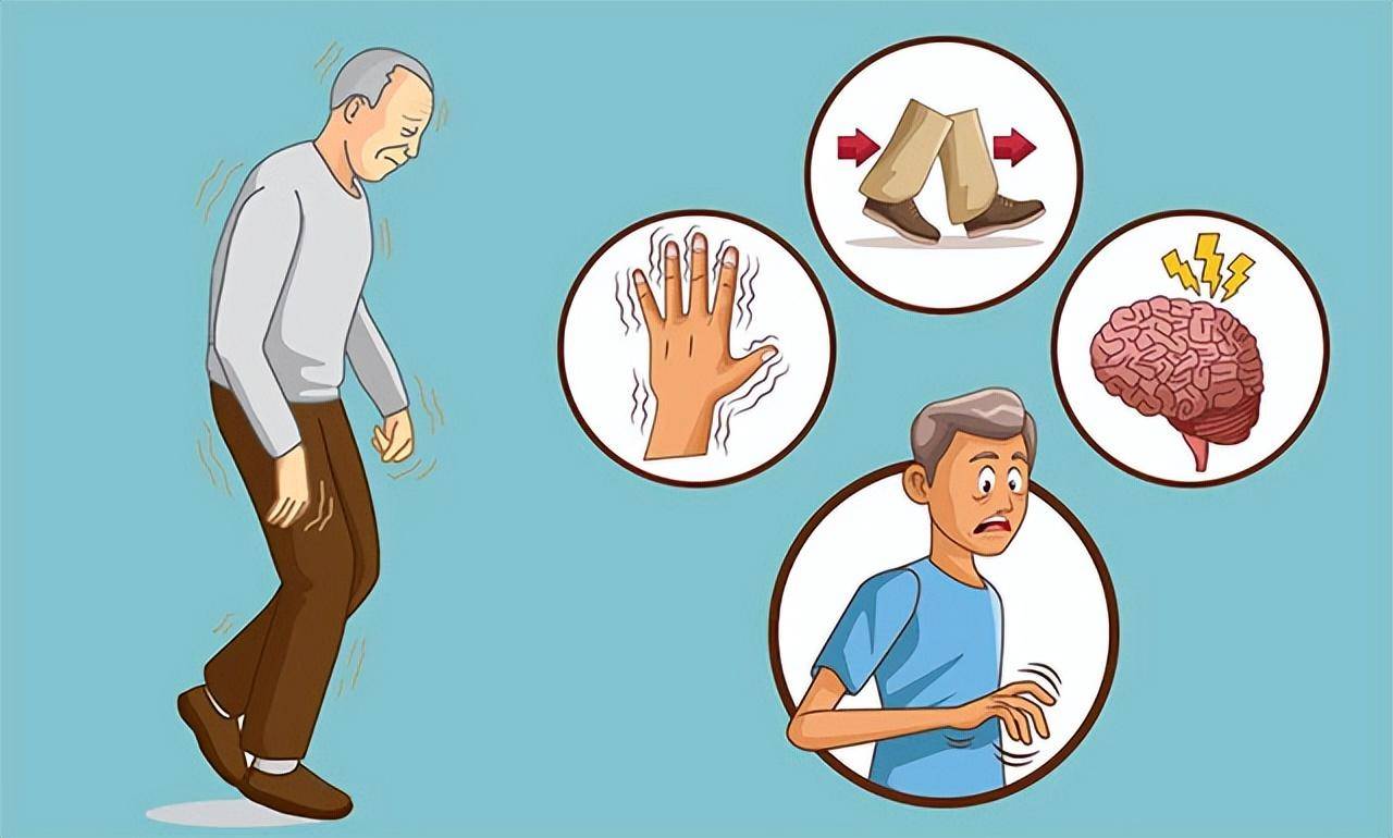 手抖就一定是帕金森?又该如何治疗?_患者_症状_疾病