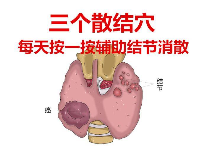 原创            常按三个穴位，行气祛湿化瘀，清除一切“淤堵”，消散全身结节(祛湿气最好的方法目前最有效的)
