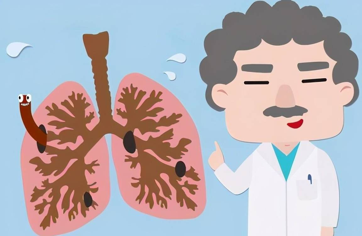 双肺结核能治得好吗?_治疗_严重_过程