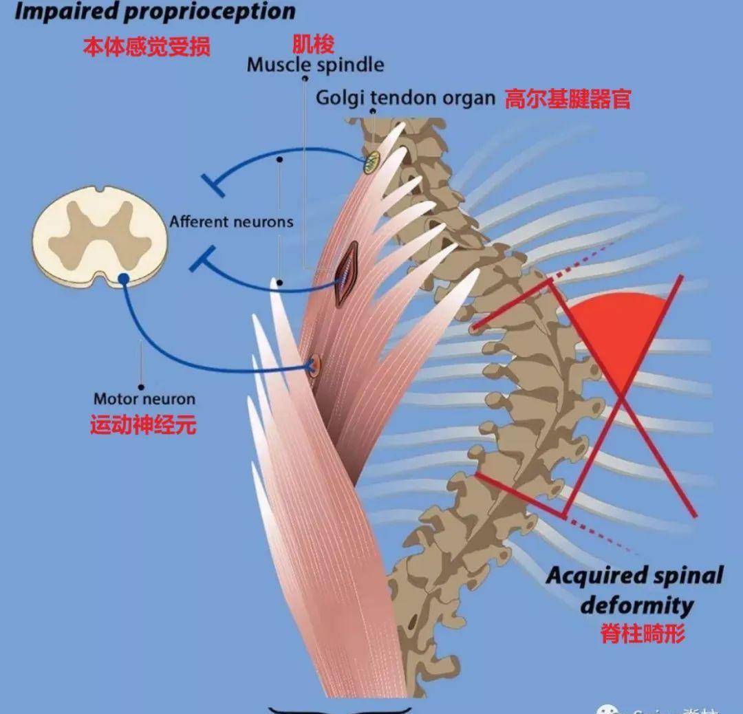此外,本体感觉系统也参与调控脊柱序列,与脊柱畸形相关.