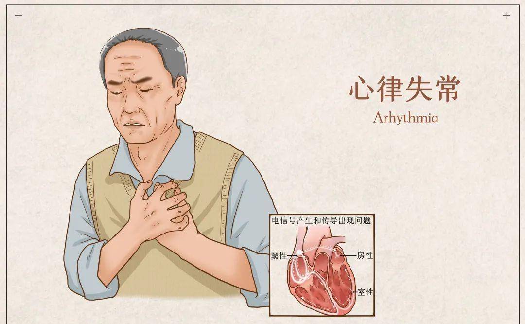 每周一药丨二参复脉胶囊:温阳益气,宽胸复脉_功效_西洋参_丹参