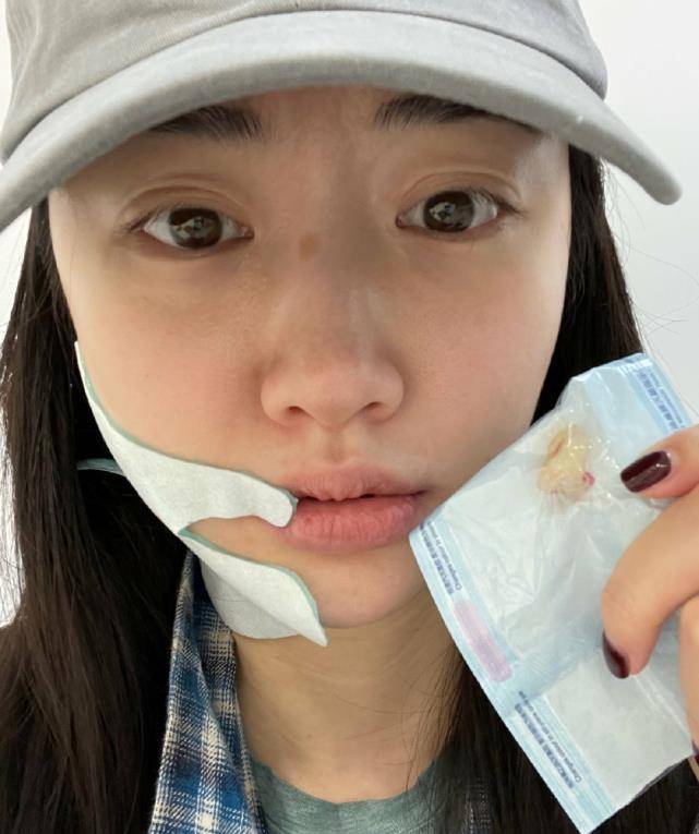 晒素颜照,双眼皮手术痕迹明显,曾坦言十分后悔整容_合作_眼睛_前景
