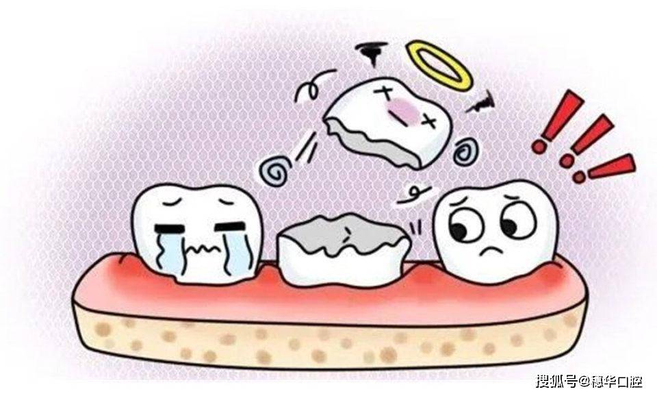 不小心遇到牙外伤?这份应急处理指南请收下_牙齿_建议_严重