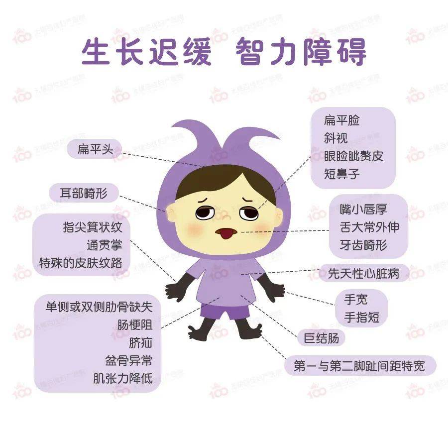 唐氏儿高发!诱因多半源于父母,星晨妇儿提醒:这类孕妈需注意!
