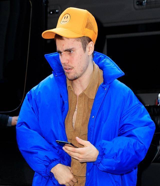 因为家族遗传,比伯也患上了莱姆病,这种病让他抑郁了很久.