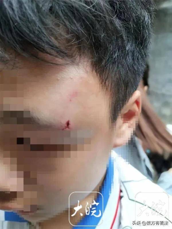 伤情就是违法轻重和相关惩罚的一个标准,如果导致轻微伤或者皮外伤