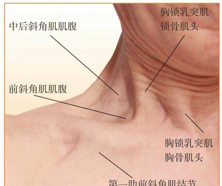 斜角肌胸锁乳突肌图片