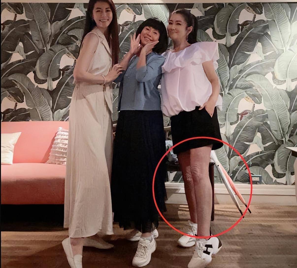 selina任家萱怀孕过首个母亲节,送妈妈珍珠项链,大方晒腿部疤痕_妹妹