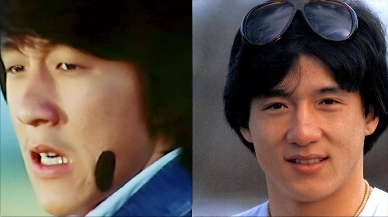 在缝针的时候,他又突发奇想:"如果我割个双眼皮,会不会好看一些.