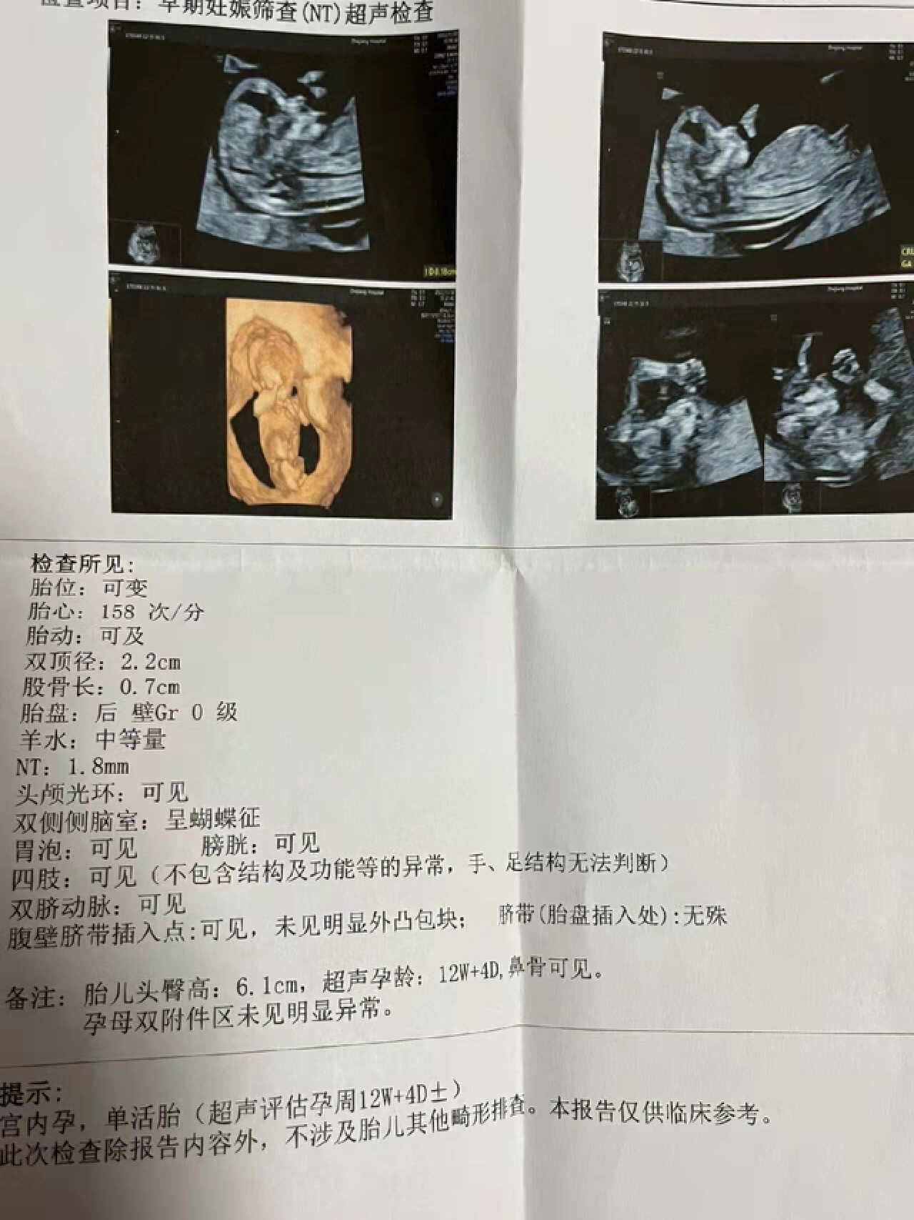 p搜索"浙里健康"选择里面的"报告查询"可以查看6个月内的b超包括图像