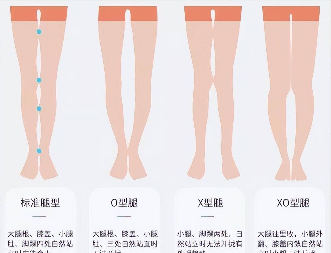 女生爱穿的瑜伽裤,啥身材穿好看?效果不同反映了哪些健康问题?_骨盆_