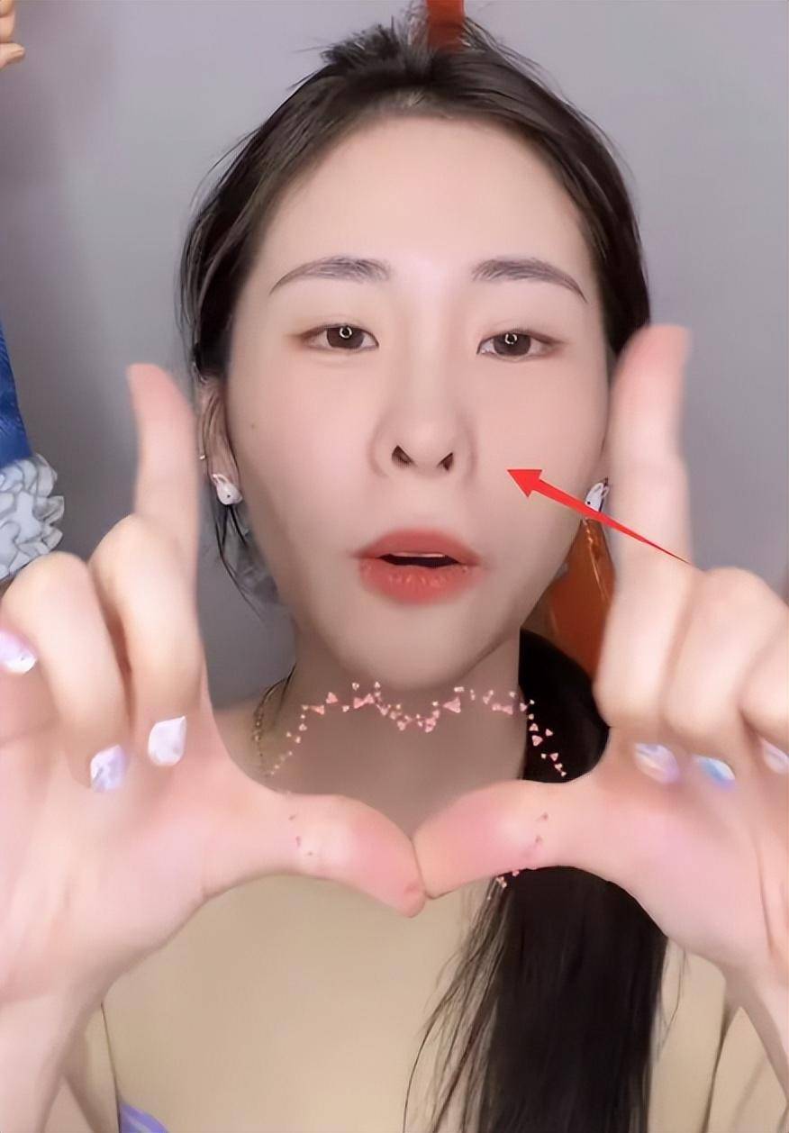 张碧晨陷整容风波,嘴歪脸斜鼻孔外翻似牛魔王,发际线后移认不出