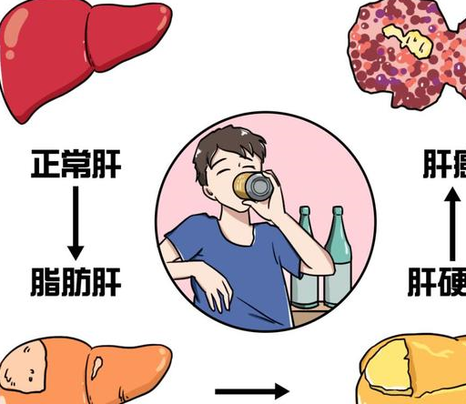 原创            脂肪肝是如何形成的？有哪些危害？该如何消除？一文给大家解答