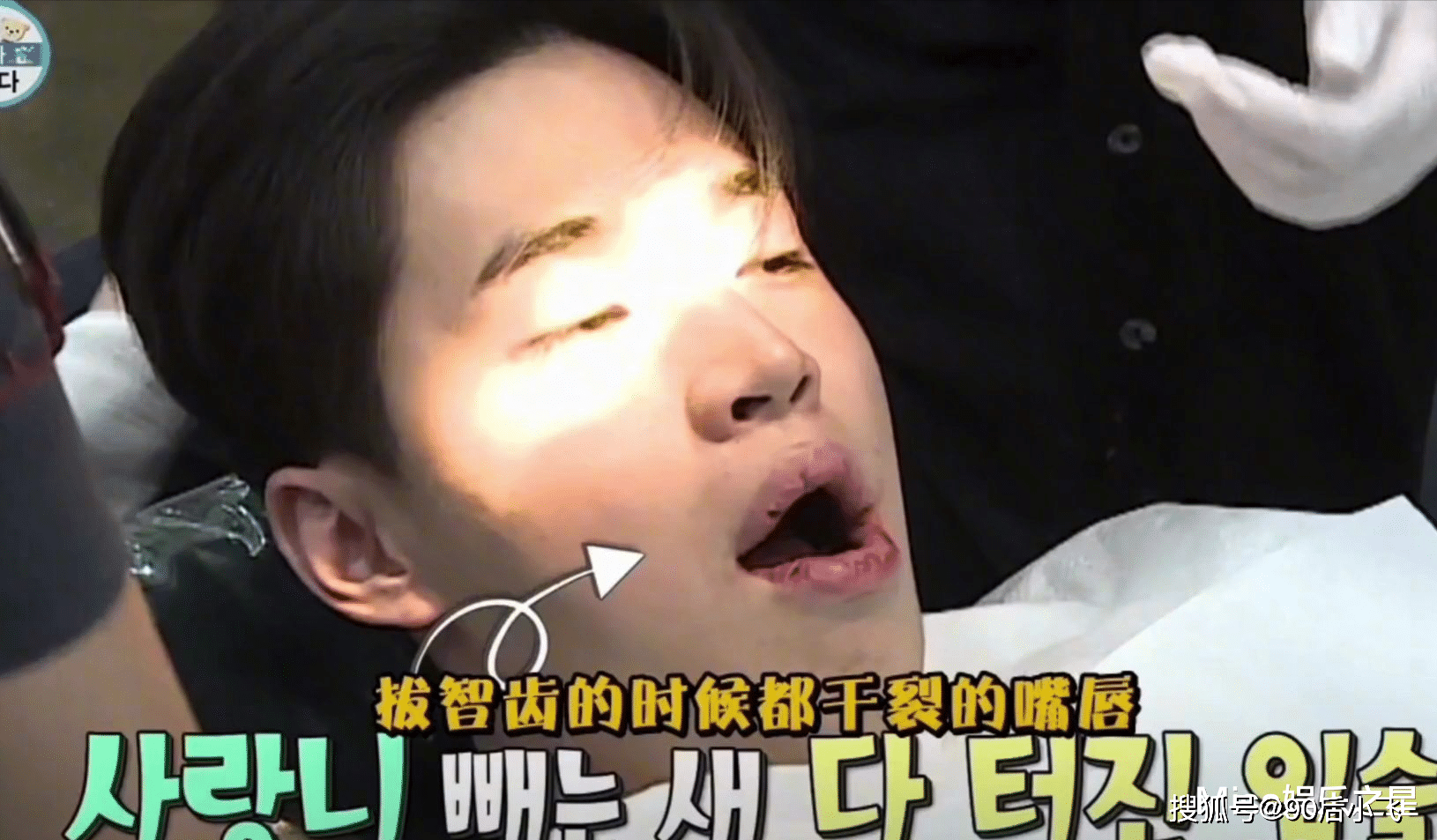 明星刘宪华被经纪人骗去拔智齿,一顿操作下来肿得像蜜蜂狗_大华_医生