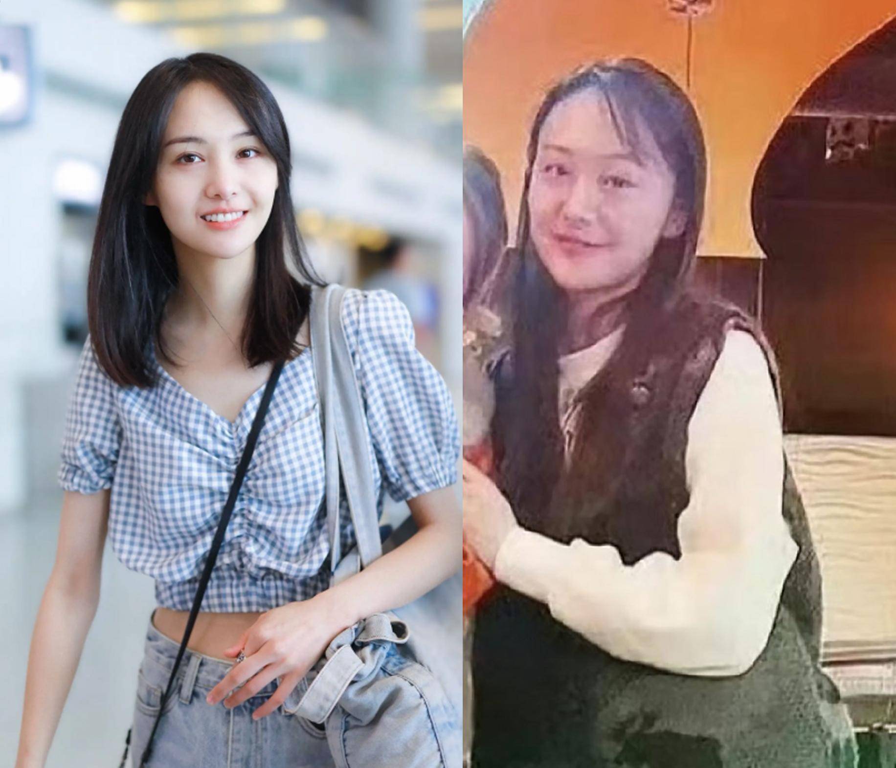 郑爽海外生活曝光:体重暴增,头发稀疏,失去少女感的真实一面引发热议!