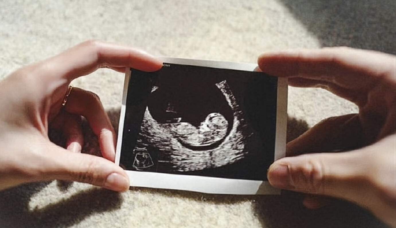怀孕三个月男孩b超图图片