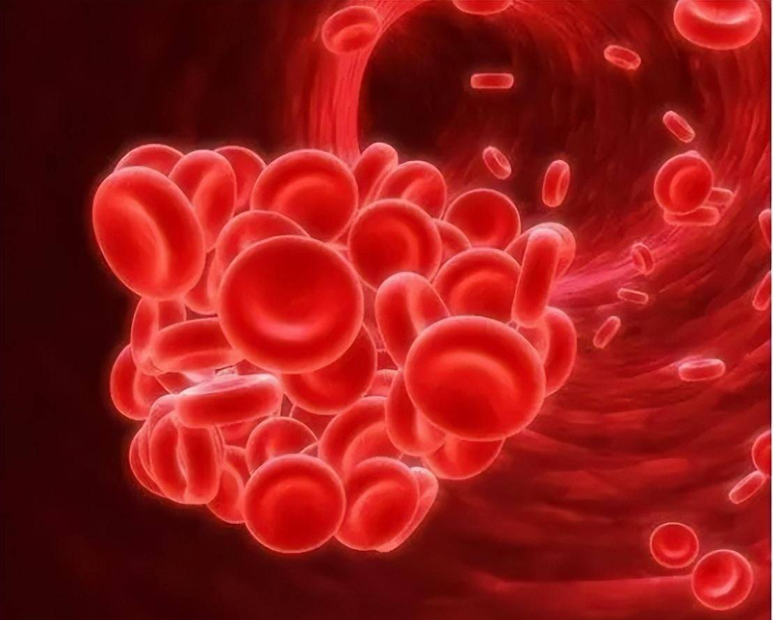 地中海贫血患者常涉及止血失调的并发症,血小板功状态是怎样的?_红细