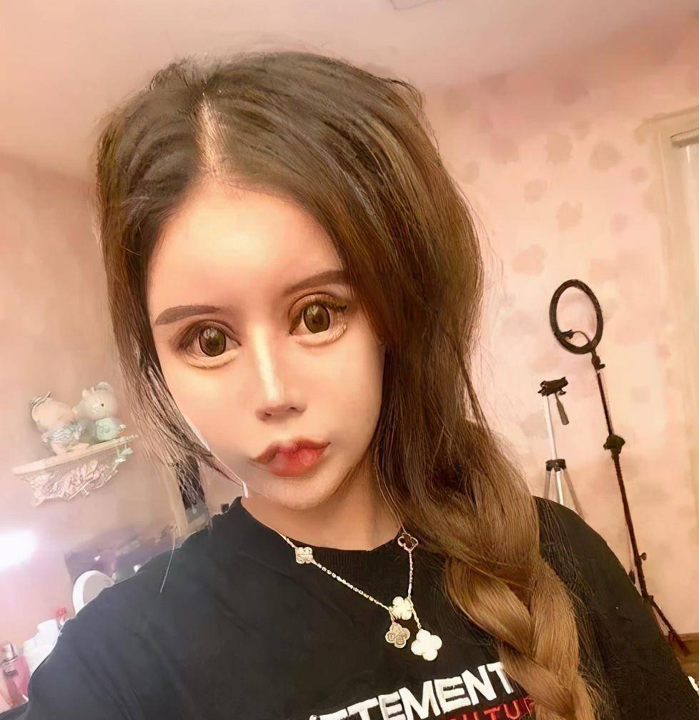 3年整容60次花费百万,现状判若两人_影响_社会_娜娜