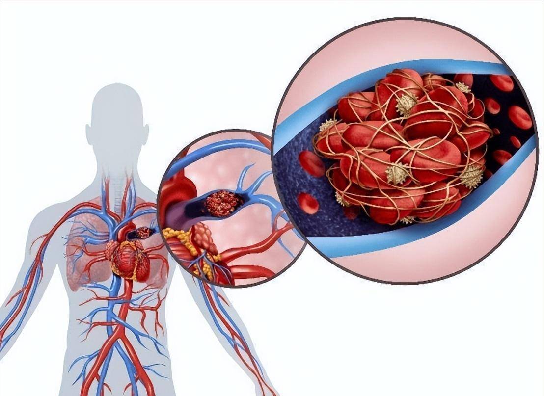 炎症_介质_组织学