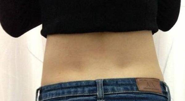 仅3%的女性才会有?_遗传_影响_子宫