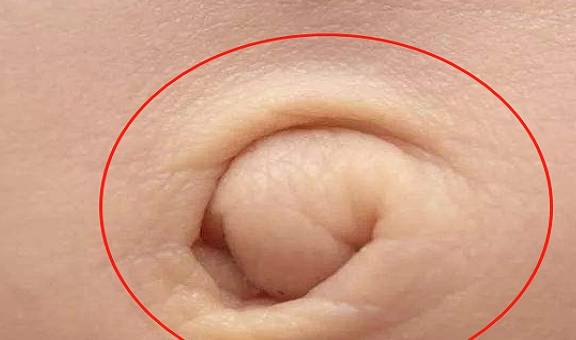 怀孕后肚脐如果是"凸"的,暗示腹中是男孩?